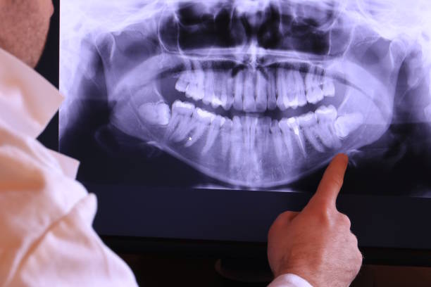 Best Emergency Gum Treatment in Bristol, WI